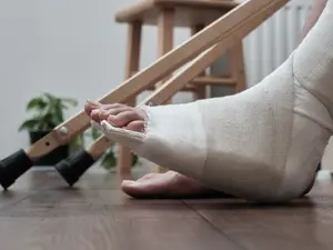 What did the person with a broken leg say to their valentine?